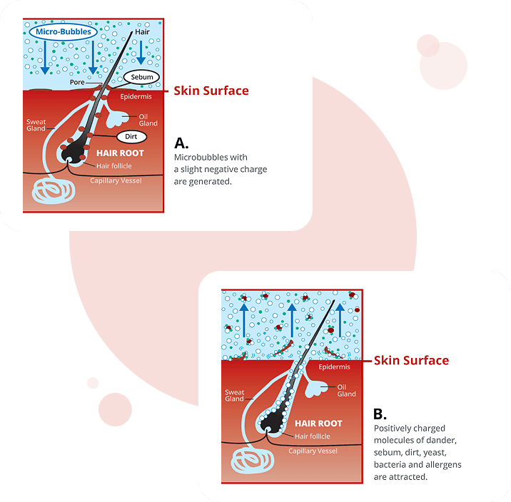Cross section of a hair follicle. Negatively charged microbubbles travel down past the epidermis to the hair root, then carry dander, sebum, dirt, yeast, bacteria and allergens back up and out.